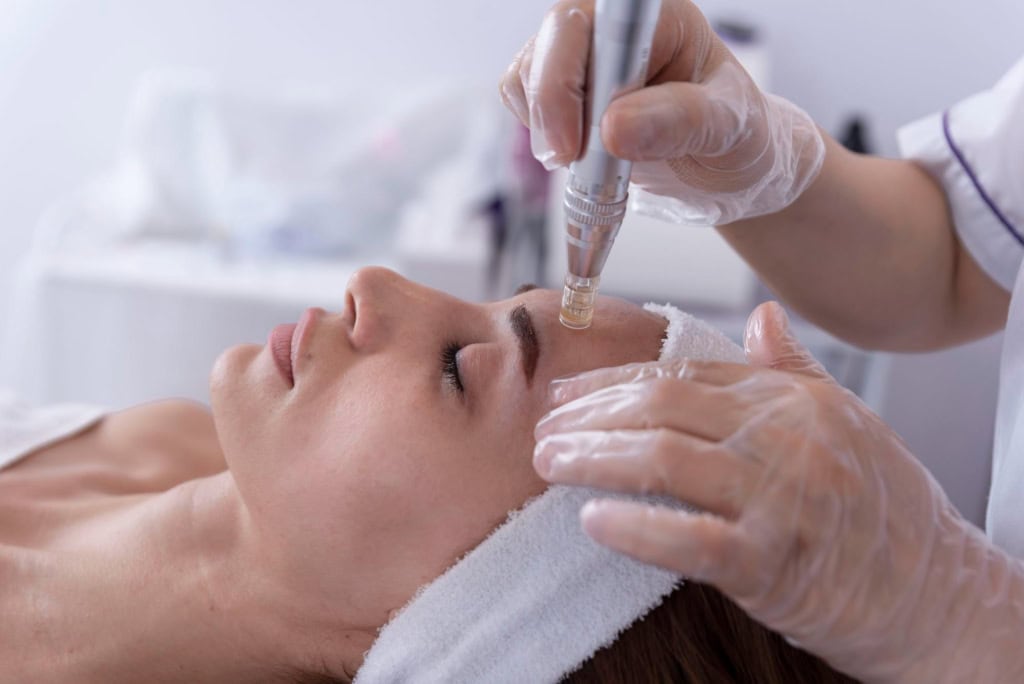 Dermapen Mesotherapy Treatment